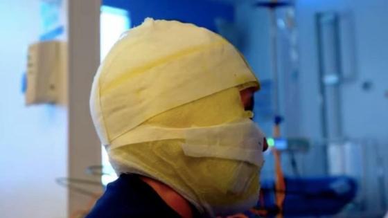 El uso de pólvora sigue dejando víctimas en Bogotá. 