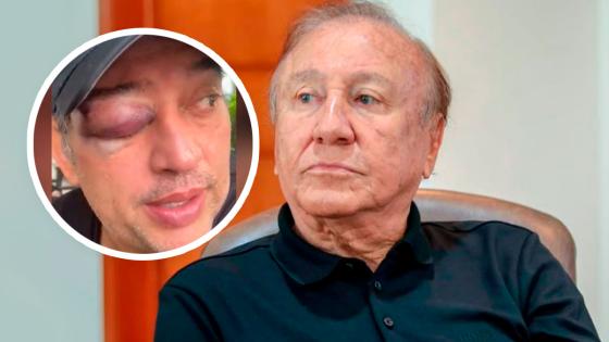 Hijo de excandidato presidencial fue golpeado Mauricio Hernández