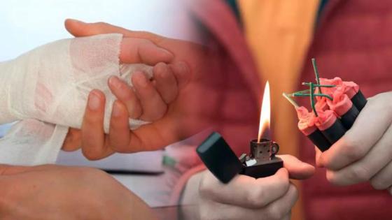 Tratar una quemadura navideña a tiempo puede evitar complicaciones. 