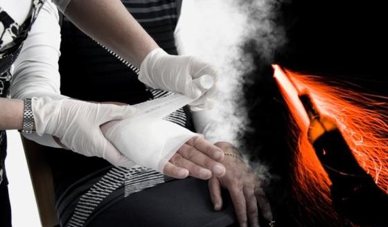 Quemados por pólvora en Bogotá