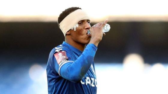 Yerry Mina lesión Yerry Mina lesión