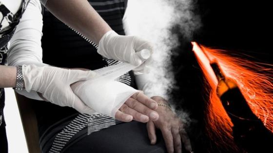 Quemados por pólvora en Bogotá