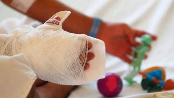 El uso de pólvora dejó 104 personas lesionadas en Bogotá