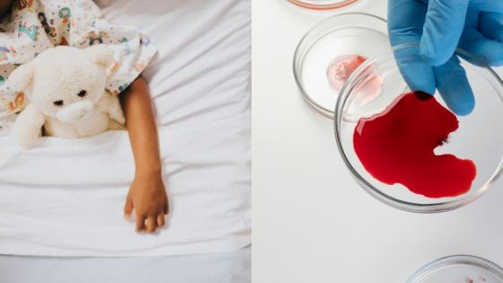 Imagen de referencia de niño con hemofilia. 